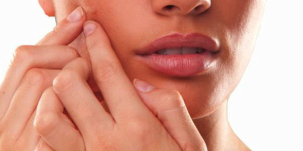 Comment protéger la peau de l’acné ?