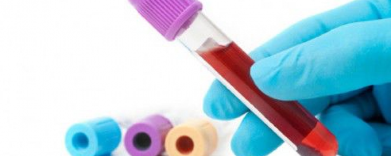 Que faire en cas de taux d’hémoglobine supérieur à la normale